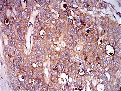 Immunohistochemistry (Formalin/PFA-fixed paraffin-embedded sections) - Anti-CD73 antibody [4G6E3] (AB202122), expandable thumbnail