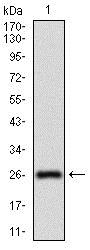 Western blot - Anti-CD73 antibody [4G6E3] (ab202122), expandable thumbnail