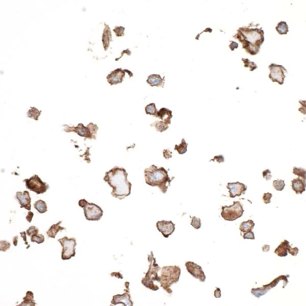 Immunocytochemistry - Anti-CD73 antibody [BLR054F] - BSA free (AB314071)