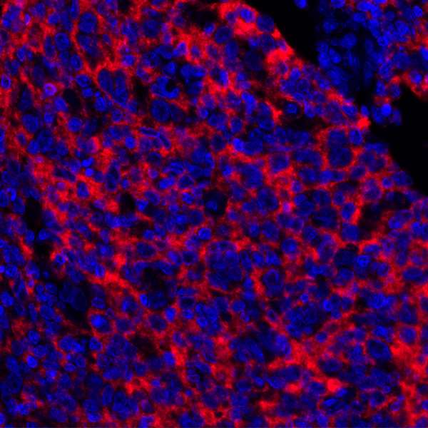 Immunohistochemistry (Formalin/PFA-fixed paraffin-embedded sections) - Anti-CD73 antibody [BLR054F] - BSA free (AB314071), expandable thumbnail