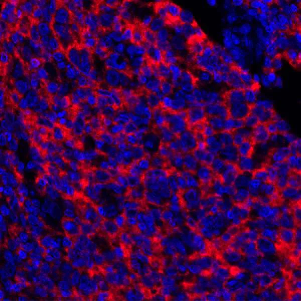 Immunohistochemistry (Formalin/PFA-fixed paraffin-embedded sections) - Anti-CD73 antibody [BLR054F] - BSA free (AB314071)