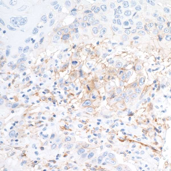 Immunohistochemistry (Formalin/PFA-fixed paraffin-embedded sections) - Anti-CD73 antibody [BLR054F] - BSA free (AB314071), expandable thumbnail