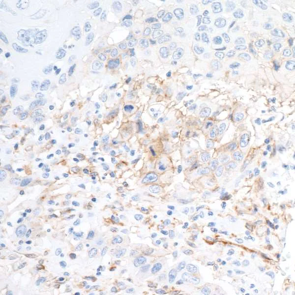 Immunohistochemistry (Formalin/PFA-fixed paraffin-embedded sections) - Anti-CD73 antibody [BLR054F] - BSA free (AB314071)