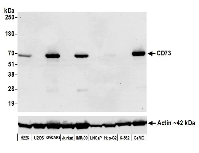 Western blot - Anti-CD73 antibody [BLR054F] - BSA free (AB314071)