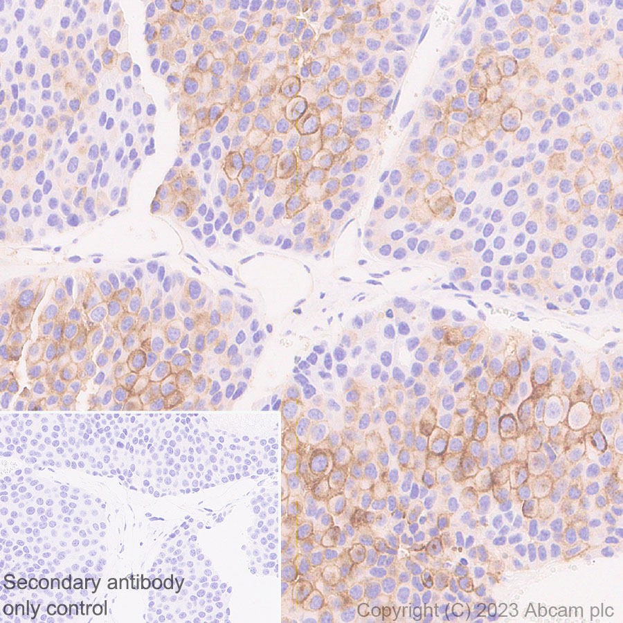 Immunohistochemistry (Formalin/PFA-fixed paraffin-embedded sections) - Anti-CD73 antibody [EPR28214-169] (ab314327), expandable thumbnail