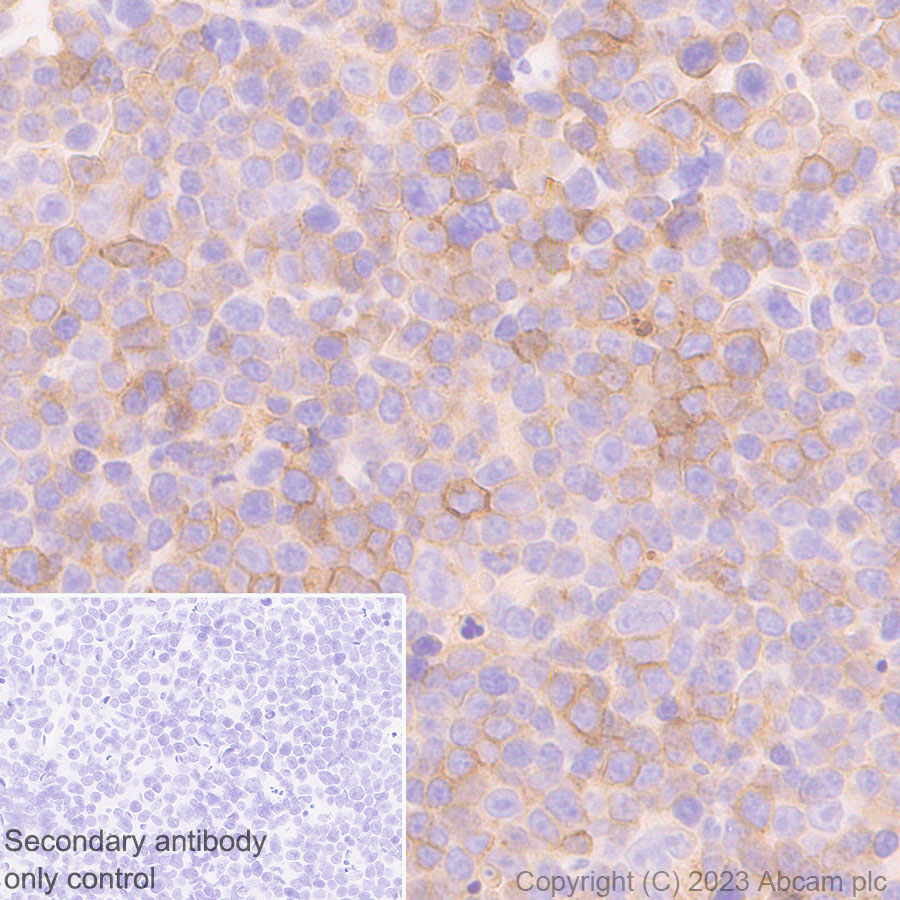 Immunohistochemistry (Formalin/PFA-fixed paraffin-embedded sections) - Anti-CD73 antibody [EPR28214-169] (AB314327), expandable thumbnail