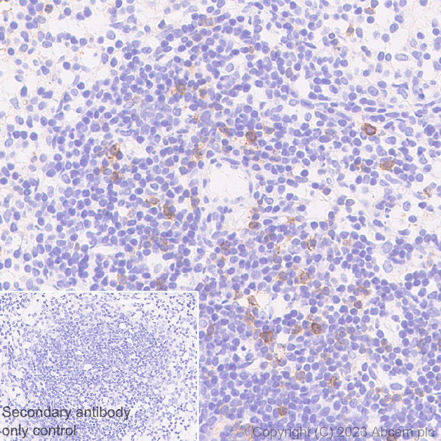 Immunohistochemistry (Formalin/PFA-fixed paraffin-embedded sections) - Anti-CD73 antibody [EPR28214-169] (ab314327), expandable thumbnail