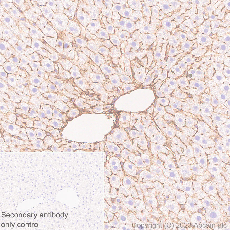 Immunohistochemistry (Formalin/PFA-fixed paraffin-embedded sections) - Anti-CD73 antibody [EPR28214-169] (ab314327), expandable thumbnail