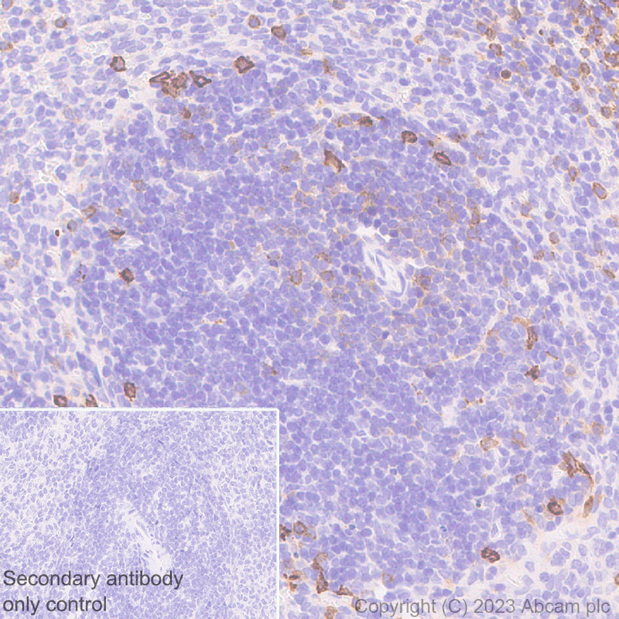 Immunohistochemistry (Formalin/PFA-fixed paraffin-embedded sections) - Anti-CD73 antibody [EPR28214-169] (ab314327), expandable thumbnail