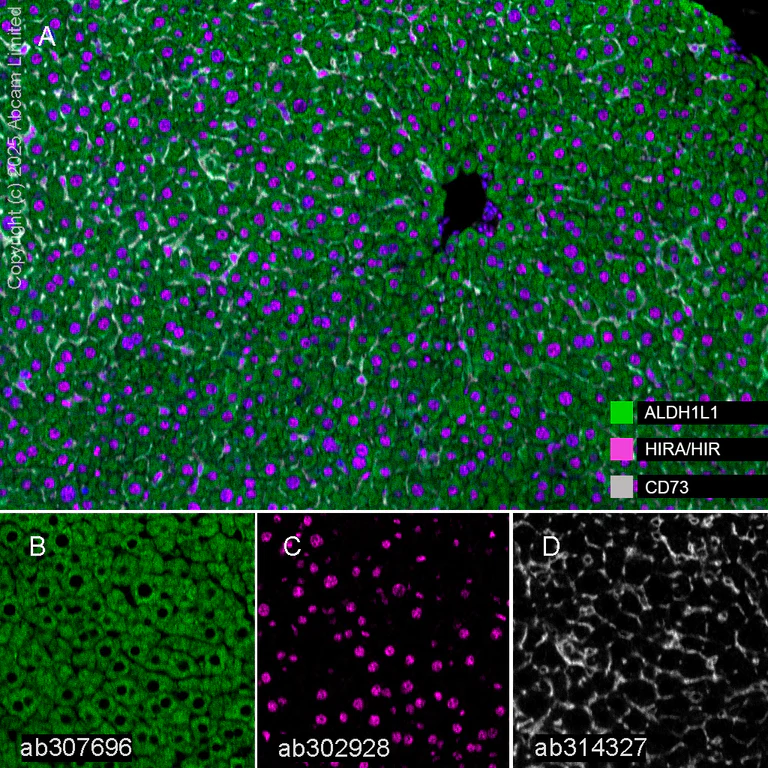 Multiplex immunohistochemistry - Anti-CD73 antibody [EPR28214-169] (AB314327)
