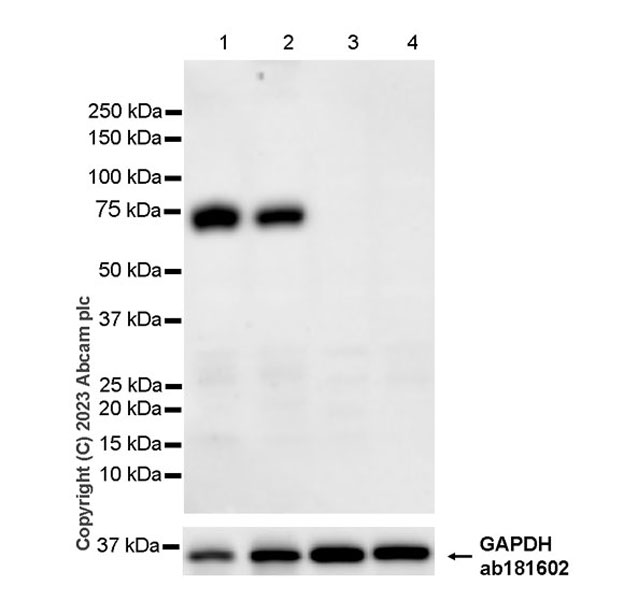 Western blot - Anti-CD73 antibody [EPR28214-169] (AB314327), expandable thumbnail