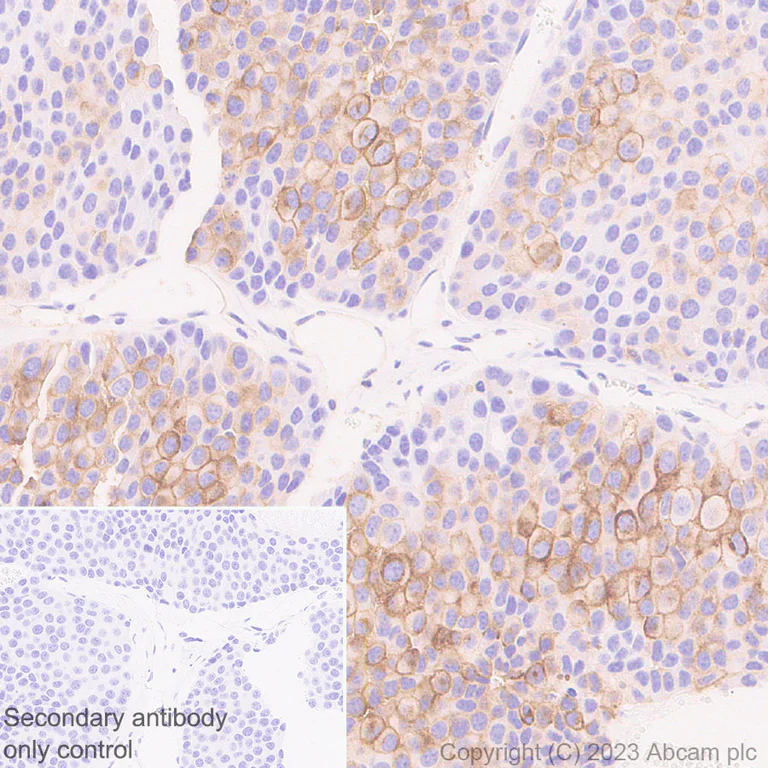 Immunohistochemistry (Formalin/PFA-fixed paraffin-embedded sections) - Anti-CD73 antibody [EPR28214-169] - BSA and Azide free (AB314328)