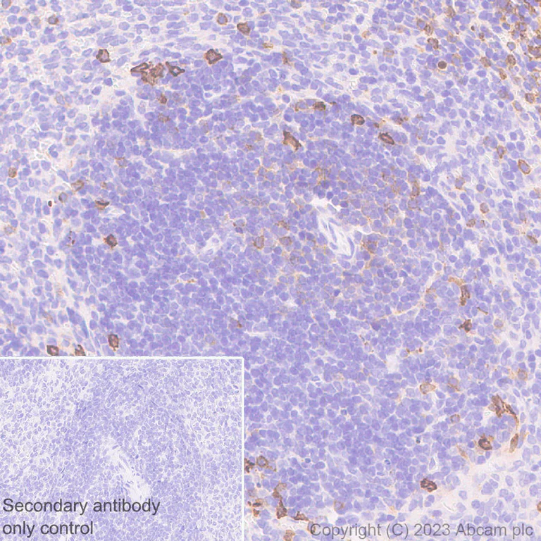 Immunohistochemistry (Formalin/PFA-fixed paraffin-embedded sections) - Anti-CD73 antibody [EPR28214-169] - BSA and Azide free (AB314328)