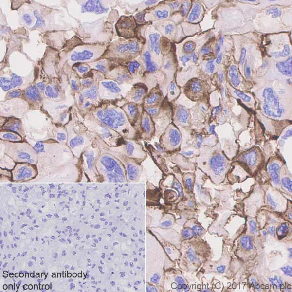 Immunohistochemistry (Formalin/PFA-fixed paraffin-embedded sections) - Anti-CD73 antibody [EPR6114] - BSA and Azide free (AB271895)