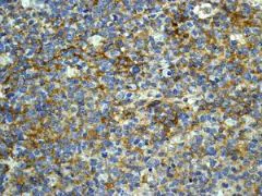 Immunohistochemistry (Formalin/PFA-fixed paraffin-embedded sections) - Anti-CD73 antibody [EPR6114] - BSA and Azide free (AB271895)