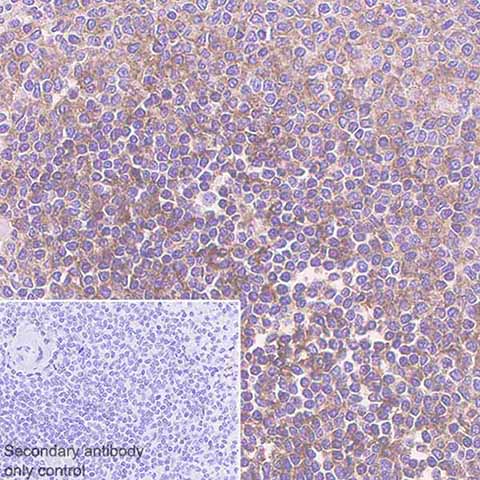 Immunohistochemistry (Formalin/PFA-fixed paraffin-embedded sections) - Anti-CD73 antibody [EPR6114] - BSA and Azide free (AB271895)