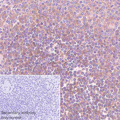 Immunohistochemistry (Formalin/PFA-fixed paraffin-embedded sections) - Anti-CD73 antibody [EPR6114] - BSA and Azide free (AB271895)