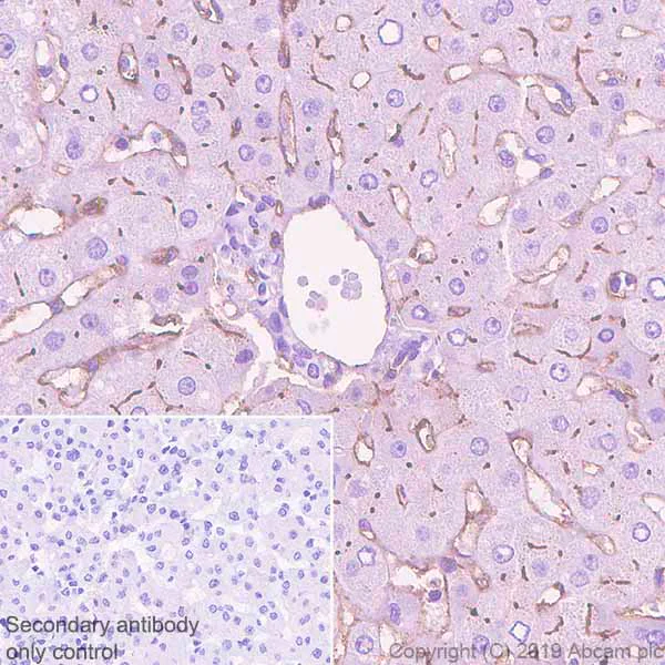 Immunohistochemistry (Formalin/PFA-fixed paraffin-embedded sections) - Anti-CD73 antibody [EPR6114] - BSA and Azide free (AB271895)