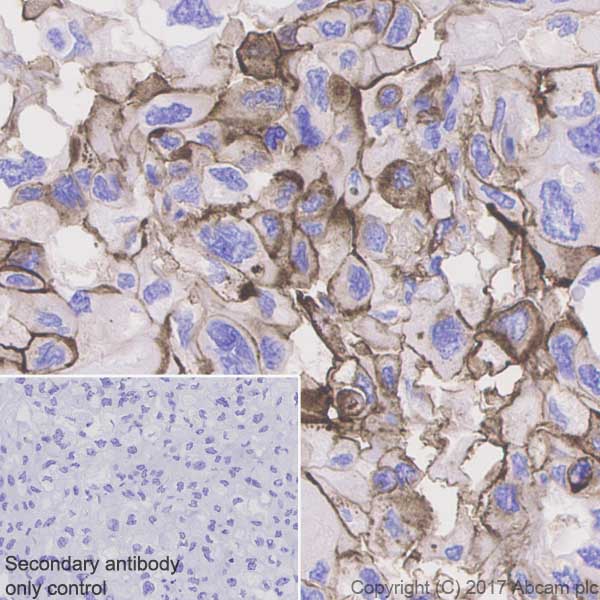 Immunohistochemistry (Formalin/PFA-fixed paraffin-embedded sections) - Anti-CD73 antibody [EPR6114] - Low endotoxin, Azide free (AB227113)
