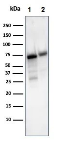 Western blot - Anti-CD73 antibody [NT5E/2503] (AB257309)