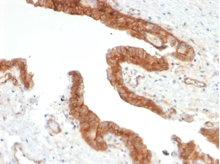 Immunohistochemistry (Formalin/PFA-fixed paraffin-embedded sections) - Anti-CD73 antibody [NT5E/2503] - BSA and Azide free (AB257329)