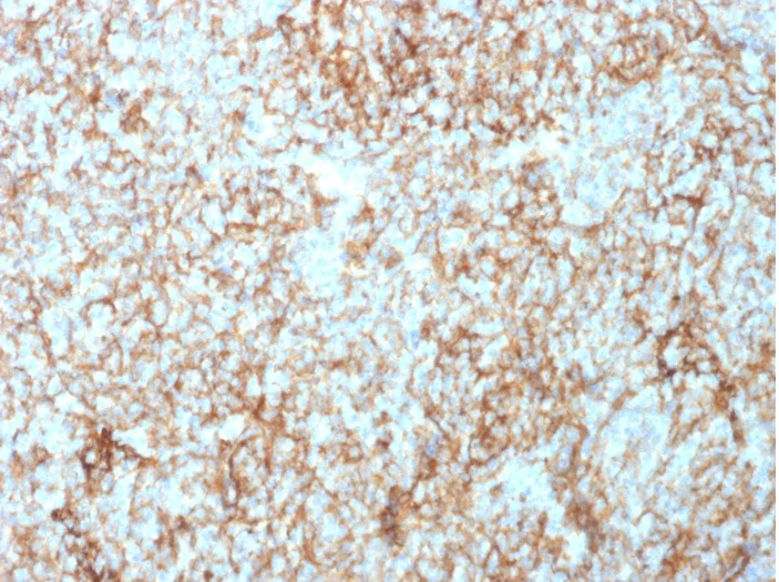 Immunohistochemistry (Formalin/PFA-fixed paraffin-embedded sections) - Anti-CD73 antibody [NT5E/2503] - BSA and Azide free (AB257329)