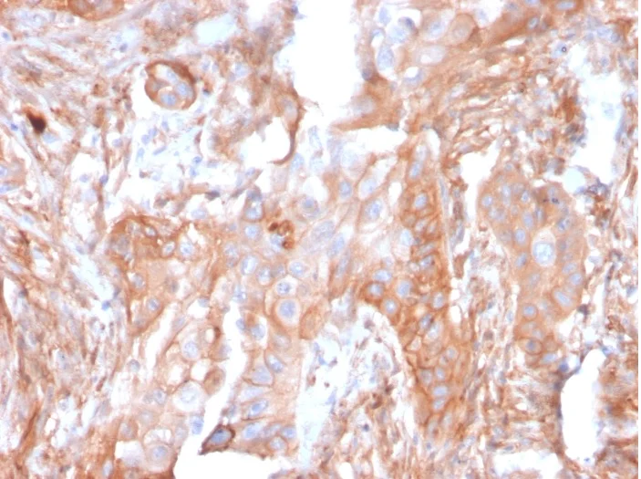 Immunohistochemistry (Formalin/PFA-fixed paraffin-embedded sections) - Anti-CD73 antibody [NT5E/2503] - BSA and Azide free (AB257329)