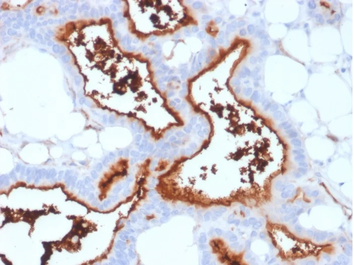 Immunohistochemistry (Formalin/PFA-fixed paraffin-embedded sections) - Anti-CD73 antibody [NT5E/2503] - BSA and Azide free (AB257329)