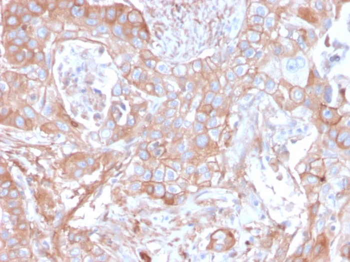 Immunohistochemistry (Formalin/PFA-fixed paraffin-embedded sections) - Anti-CD73 antibody [NT5E/2505] (AB257310)
