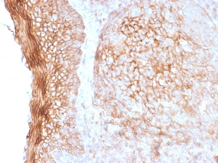 Immunohistochemistry (Formalin/PFA-fixed paraffin-embedded sections) - Anti-CD73 antibody [NT5E/2505] (AB257310)