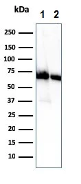 Western blot - Anti-CD73 antibody [NT5E/2505] (AB257310)
