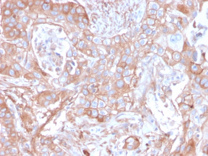 Immunohistochemistry (Formalin/PFA-fixed paraffin-embedded sections) - Anti-CD73 antibody [NT5E/2505] - BSA and Azide free (AB259262), expandable thumbnail