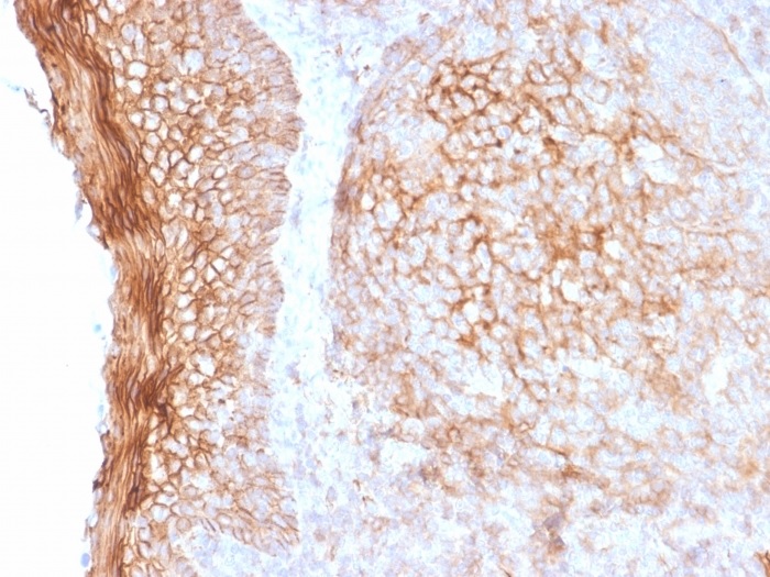 Immunohistochemistry (Formalin/PFA-fixed paraffin-embedded sections) - Anti-CD73 antibody [NT5E/2505] - BSA and Azide free (AB259262), expandable thumbnail