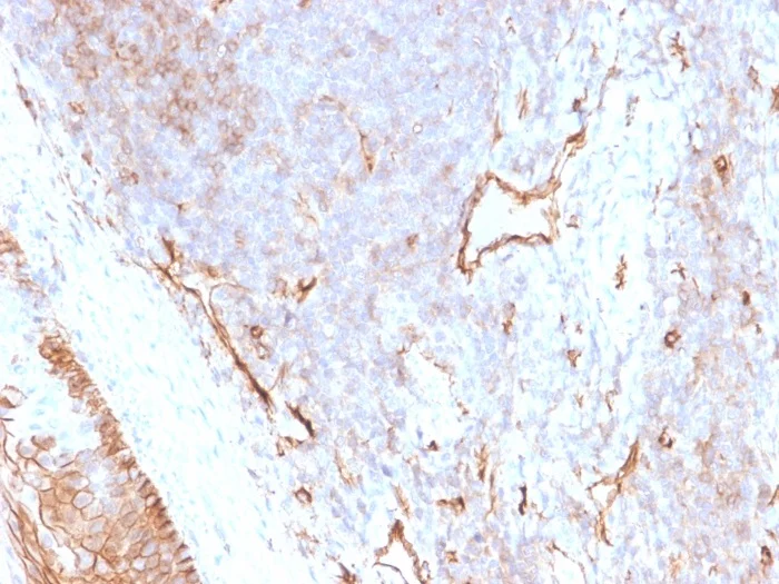 Immunohistochemistry (Formalin/PFA-fixed paraffin-embedded sections) - Anti-CD73 antibody [NT5E/2505] - BSA and Azide free (AB259262)