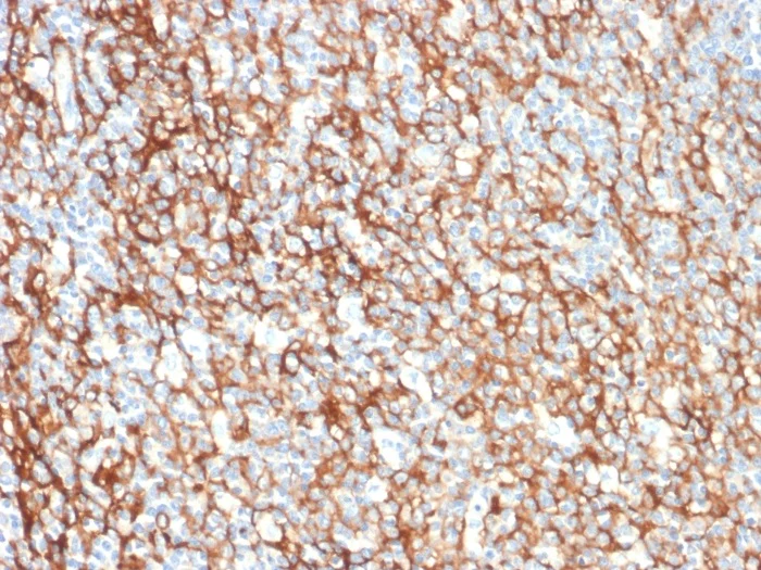 Immunohistochemistry (Formalin/PFA-fixed paraffin-embedded sections) - Anti-CD73 antibody [NT5E/2505] - BSA and Azide free (AB259262)