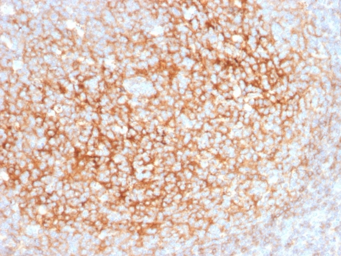 Immunohistochemistry (Formalin/PFA-fixed paraffin-embedded sections) - Anti-CD73 antibody [NT5E/2545] (AB257311), expandable thumbnail