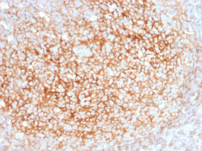 Immunohistochemistry (Formalin/PFA-fixed paraffin-embedded sections) - Anti-CD73 antibody [NT5E/2545] (AB257311)