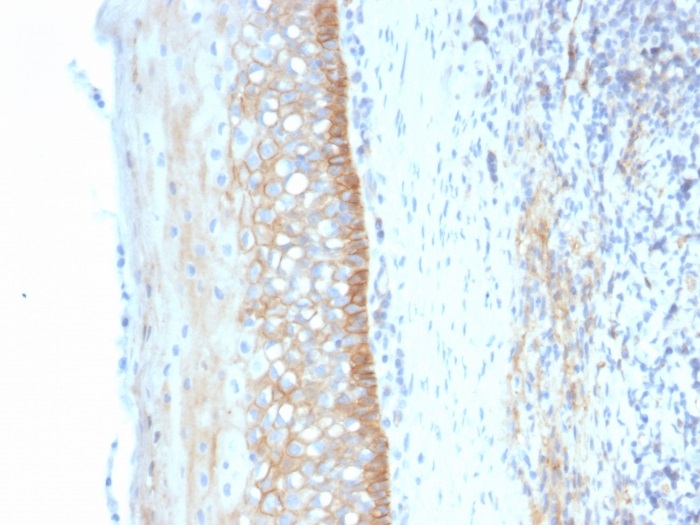 Immunohistochemistry (Formalin/PFA-fixed paraffin-embedded sections) - Anti-CD73 antibody [NT5E/2545] (AB257311), expandable thumbnail