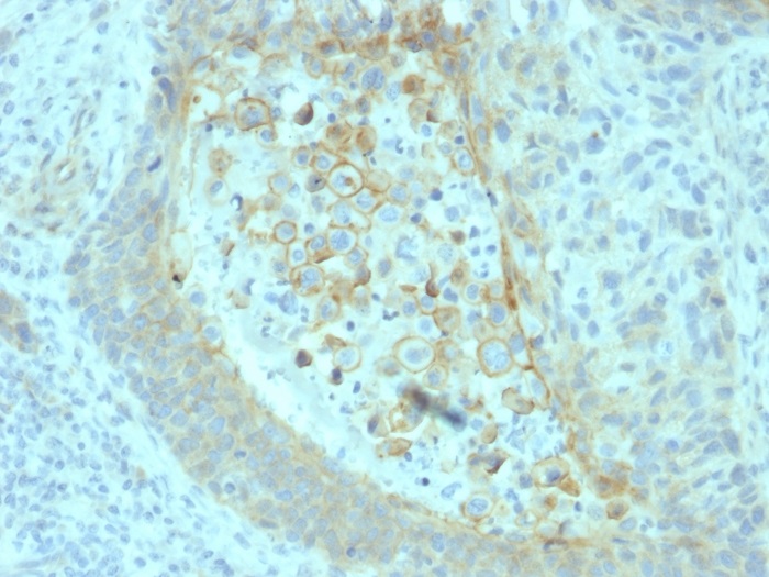Immunohistochemistry (Formalin/PFA-fixed paraffin-embedded sections) - Anti-CD73 antibody [NT5E/2545] (AB257311), expandable thumbnail