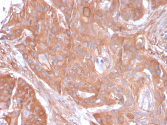 Immunohistochemistry (Formalin/PFA-fixed paraffin-embedded sections) - Anti-CD73 antibody [NT5E/2545] (ab257311), expandable thumbnail