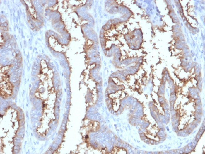 Immunohistochemistry (Formalin/PFA-fixed paraffin-embedded sections) - Anti-CD73 antibody [NT5E/2545] (AB257311), expandable thumbnail
