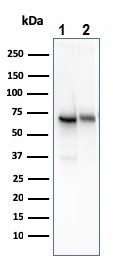 Western blot - Anti-CD73 antibody [NT5E/2545] (ab257311), expandable thumbnail