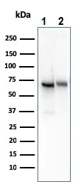 Western blot - Anti-CD73 antibody [NT5E/2545] (AB257311)