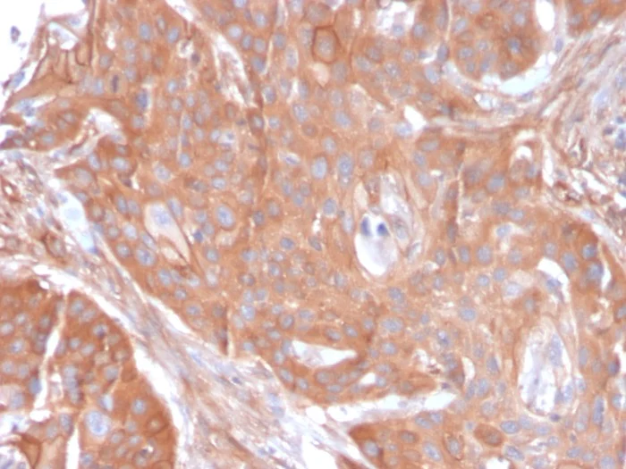 Immunohistochemistry (Formalin/PFA-fixed paraffin-embedded sections) - Anti-CD73 antibody [NT5E/2545] - BSA and Azide free (AB259282)