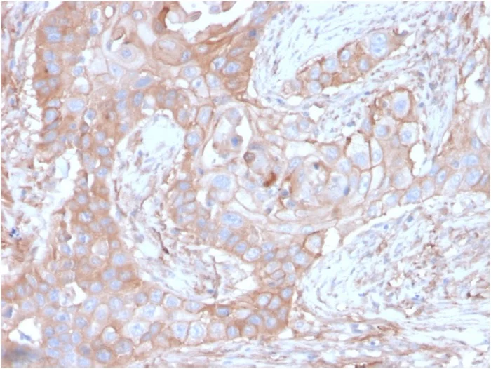 Immunohistochemistry (Formalin/PFA-fixed paraffin-embedded sections) - Anti-CD73 antibody [NT5E/2646] (AB257312)