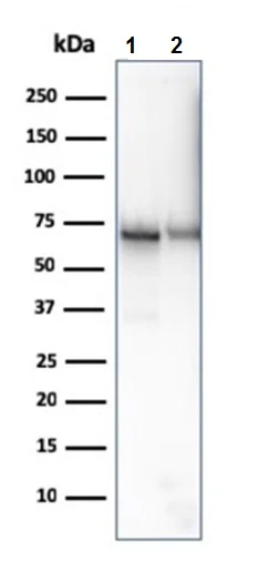 Western blot - Anti-CD73 antibody [NT5E/2646] (AB257312)