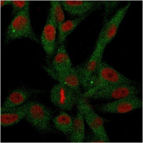 Immunocytochemistry/ Immunofluorescence - Anti-CD73 antibody [NT5E/2646] - BSA and Azide free (AB259284), expandable thumbnail