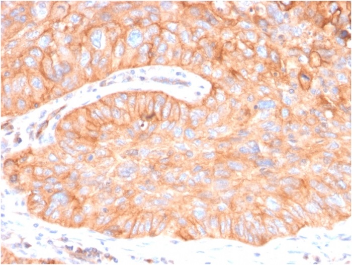 Immunohistochemistry (Formalin/PFA-fixed paraffin-embedded sections) - Anti-CD73 antibody [NT5E/2646] - BSA and Azide free (AB259284), expandable thumbnail