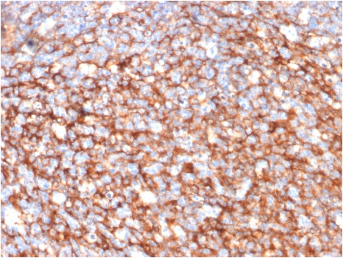 Immunohistochemistry (Formalin/PFA-fixed paraffin-embedded sections) - Anti-CD73 antibody [NT5E/2646] - BSA and Azide free (AB259284), expandable thumbnail