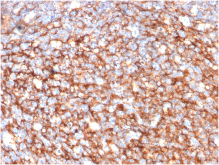 Immunohistochemistry (Formalin/PFA-fixed paraffin-embedded sections) - Anti-CD73 antibody [NT5E/2646] - BSA and Azide free (AB259284)